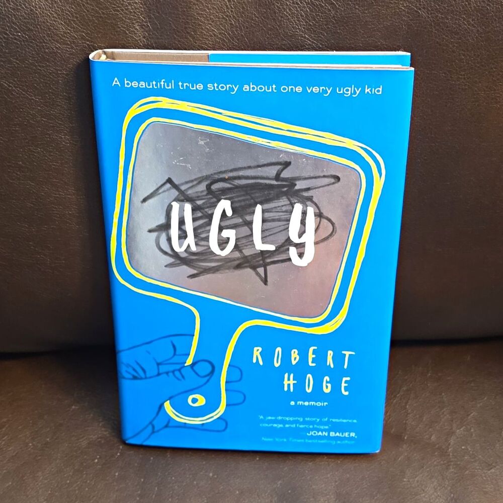 Ugly Memoir by Robert Hoge Hardcover with Dust Jacket